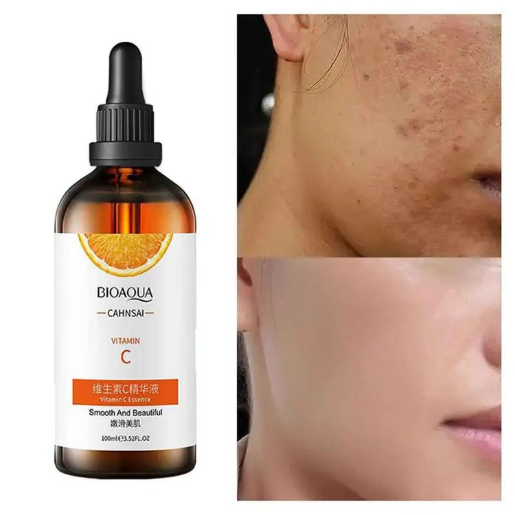 قیمت سرم ویتامین سی c بیواکوا ضدلک خرید قیمت مناسب ارزان تضمینی درمان لک